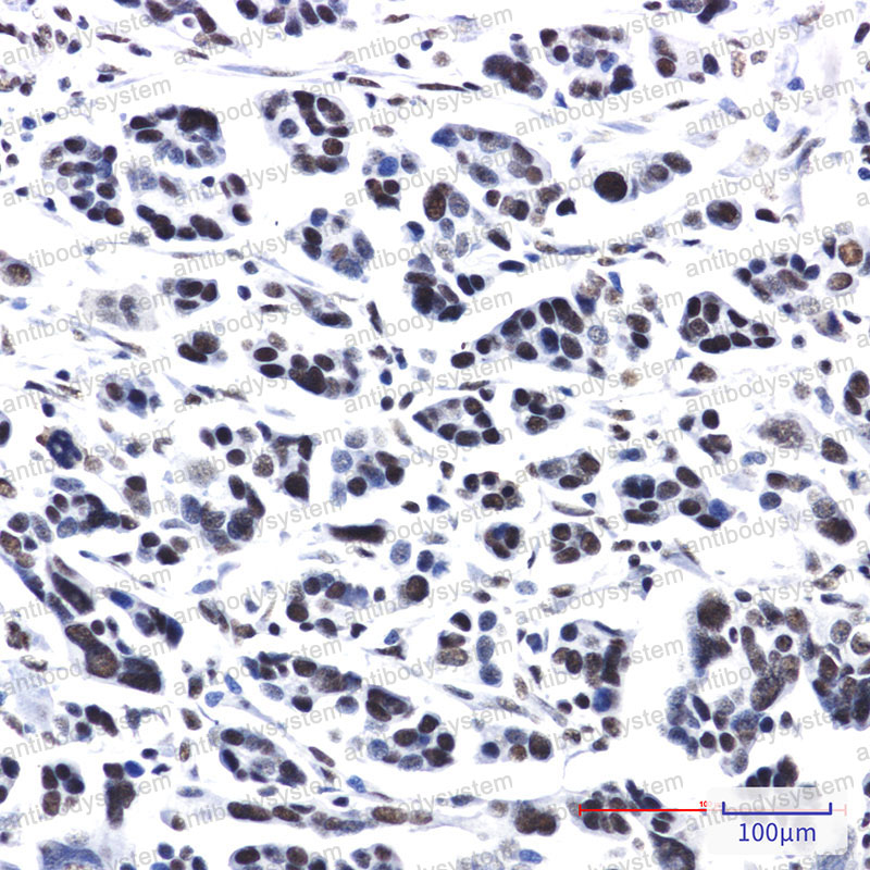 Anti-PRPF4 Antibody (R1D94)