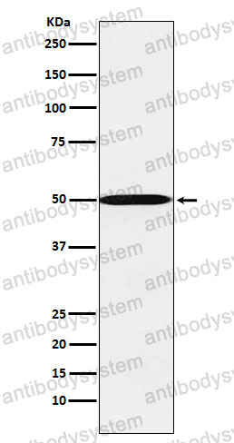 Anti-CYP26A1 Antibody (R1D95)
