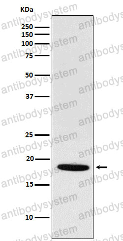 Anti-NDUFS4 Antibody (R1D97)