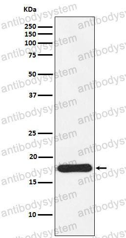 Anti-NDUFS4 Antibody (R1D96)