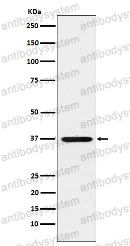 Anti-CRX Antibody (R1D98)