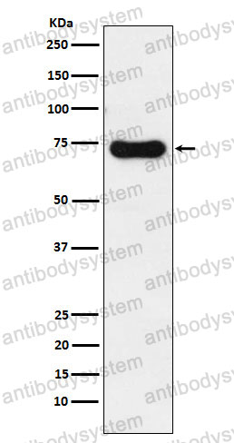 Anti-IRAK2 Antibody (R1D99)