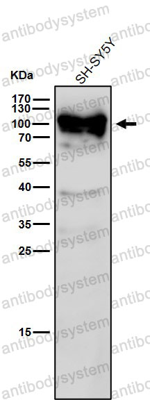 Anti-SART1 Antibody (R1E01)