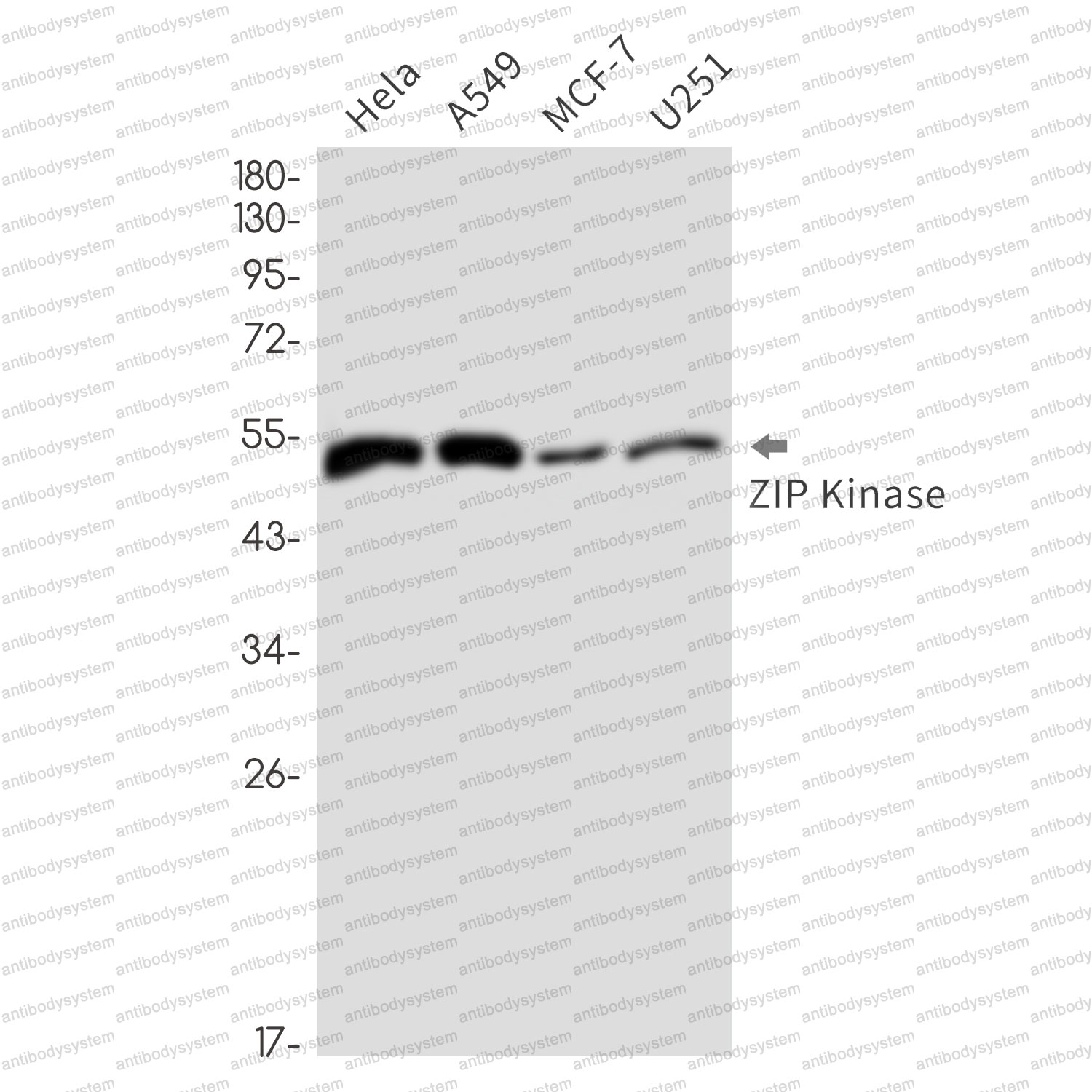 Anti-DAPK3 Antibody (R1E02)