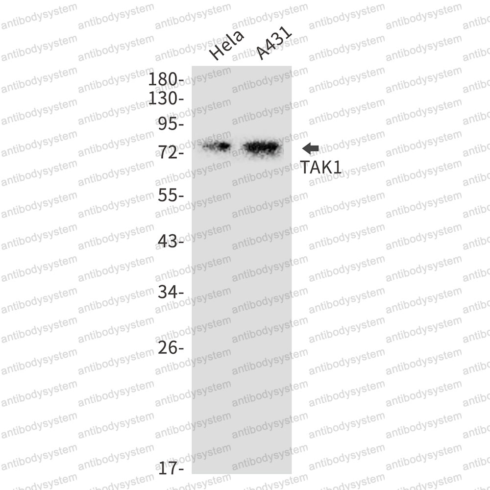 Anti-MAP3K7 Antibody (R1E04)