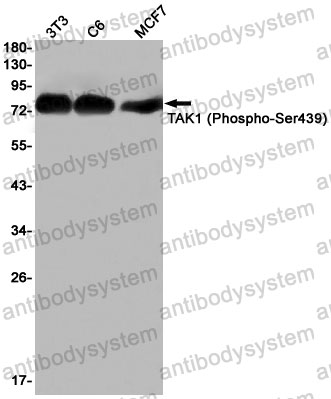 Anti-Phospho-MAP3K7/TAK1 (Ser439) Antibody (R1E03)