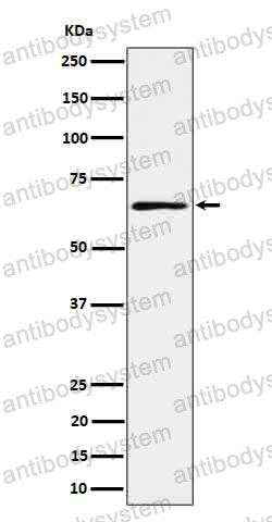 Anti-RIPK2 Antibody (R1E05)