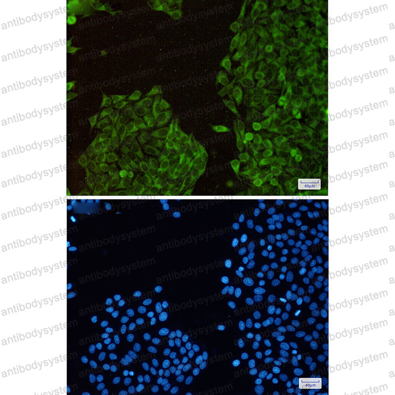 Anti-TXNL1 Antibody (R1E06)