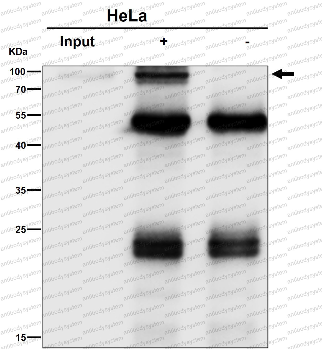 Anti-TGOLN2 Antibody (R1E09)