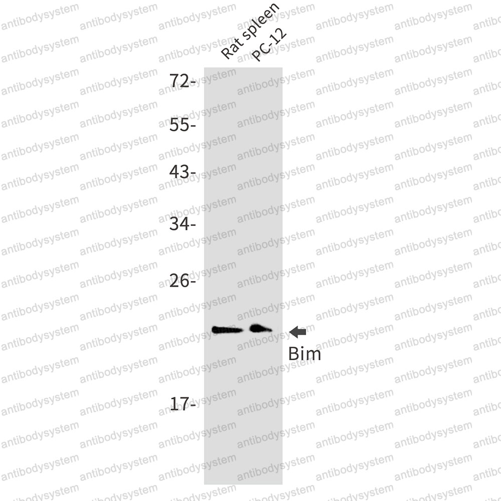 Anti-Bim/BCL2L11 Antibody (R1E10)
