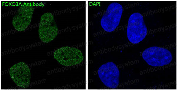 Anti-FOXO3 Antibody (R1A39)