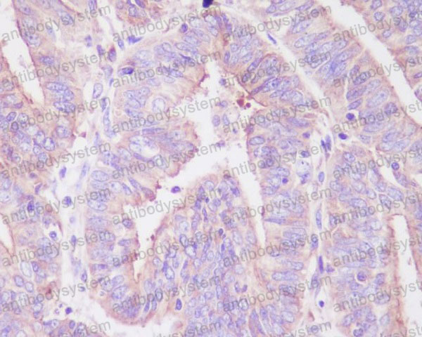 Anti-Phospho-FOXO3 (S253) Antibody (R1C48)