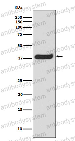 Anti-Phospho-LAT/pp36 (Y191) Antibody (R1A27)