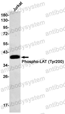 Anti-Phospho-LAT (Tyr200) Antibody (R1E16)
