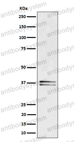 Anti-LAT Antibody (R1E15)