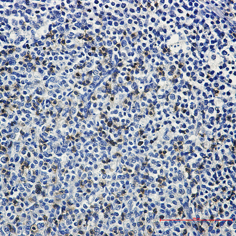 Anti-LAT Antibody (R1E17)