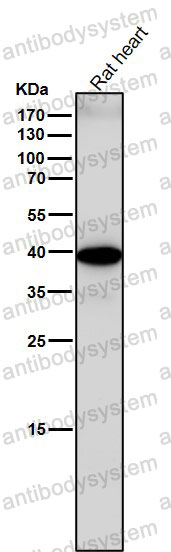 Anti-SPRY2 Antibody (R1E18)
