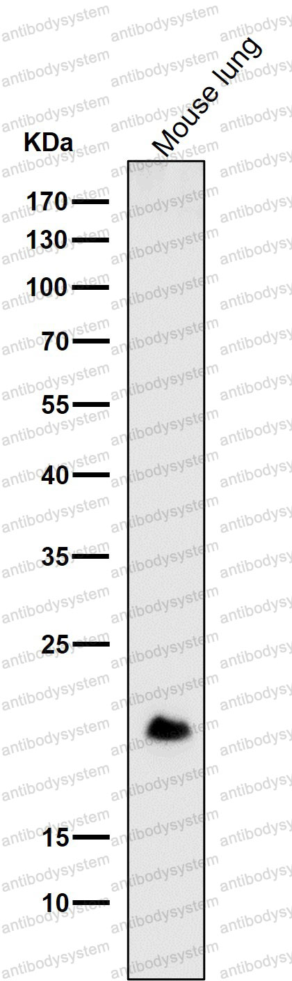 Anti-DNPH1 Antibody (R1E19)