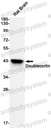 Anti-DCX Antibody (R1E20)