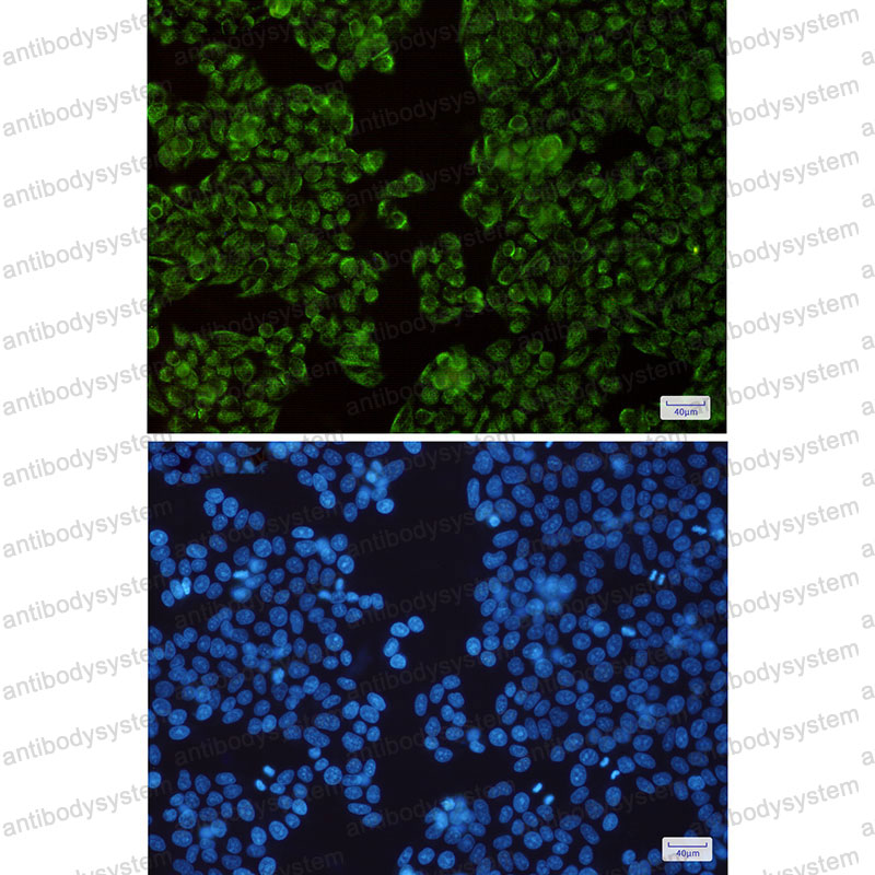 Anti-TIMM44 Antibody (R1E22)