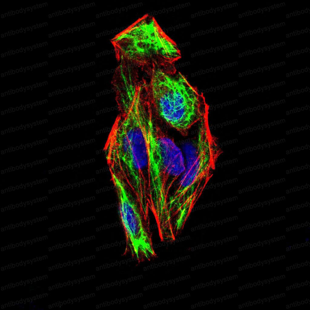 Immunofluorescence for Anti-SNAI2 Antibody (R2U97) ?>