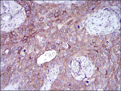 Immunohistochemical for Anti-SNAI2 Antibody (R2U97) ?>