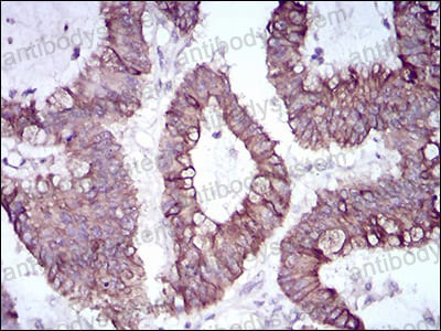 Immunohistochemical for Anti-SNAI2 Antibody (R2U97) ?>