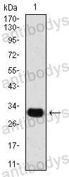 Western blot for Anti-SNAI2 Antibody (R2U97) ?>