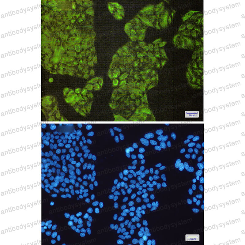 Anti-NCK2 Antibody (R1E24)