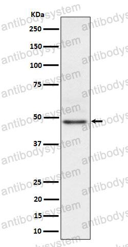 Anti-NCK2 Antibody (R1E23)