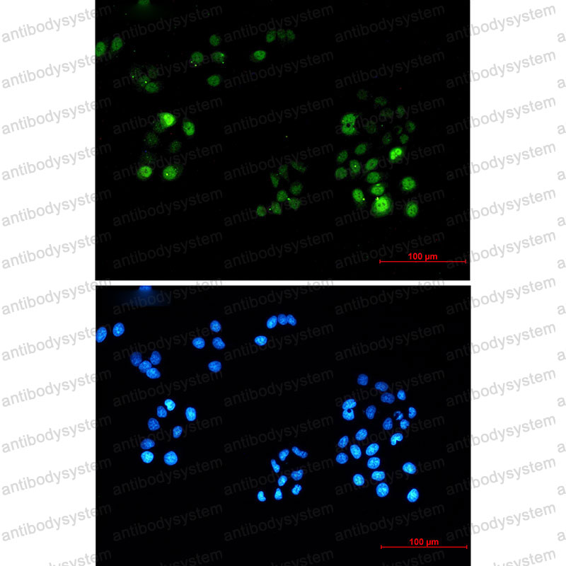 Anti-Phospho-PRC1 (Thr481) Antibody (R1E25)