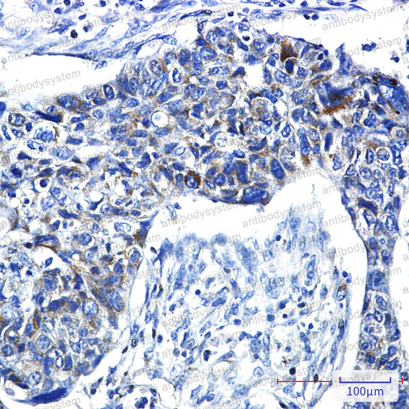 Anti-PRC1 Antibody (R1E26)
