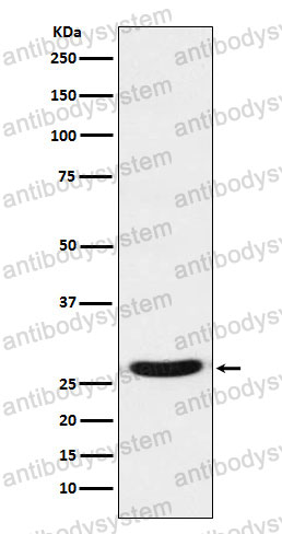 Anti-TCF21 Antibody (R1E27)