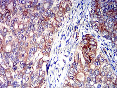 Immunohistochemical for Anti-CD327/SIGLEC6 Antibody (R2V02) ?>
