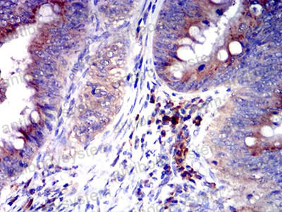 Immunohistochemical for Anti-CD327/SIGLEC6 Antibody (R2V02) ?>