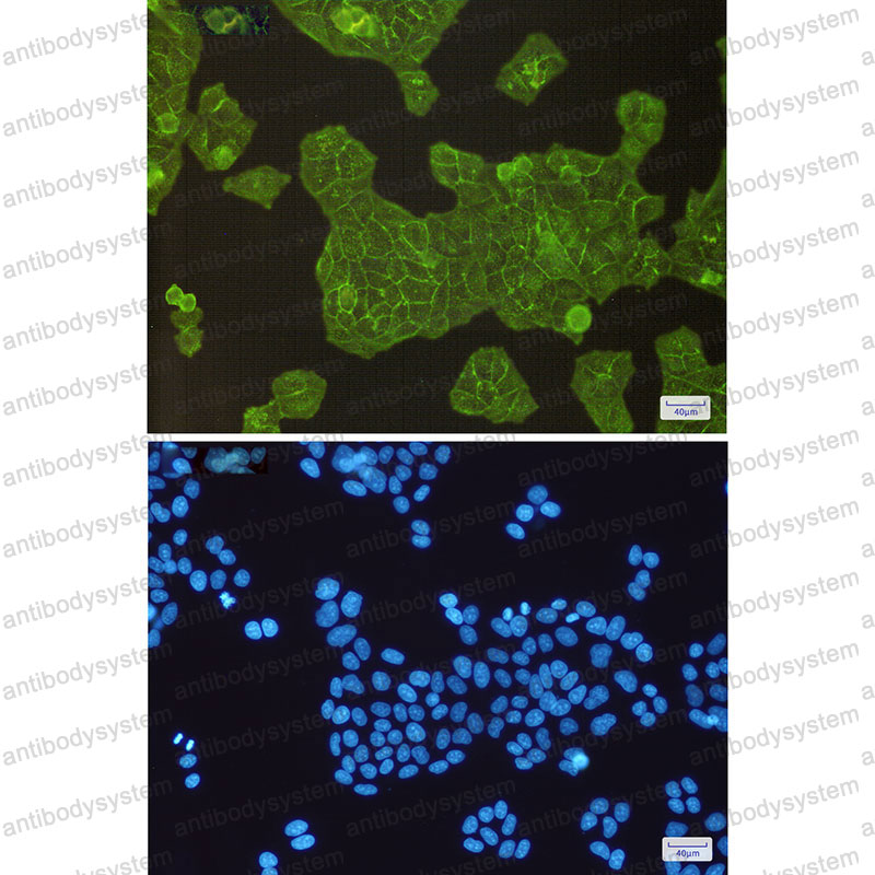 Anti-ACTN4/Actinin alpha 4 Antibody (R1E30)