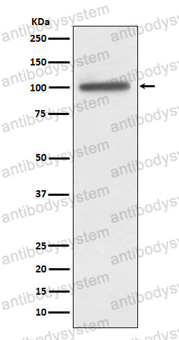 Anti-ACTN4/Actinin alpha 4 Antibody (R1E29)