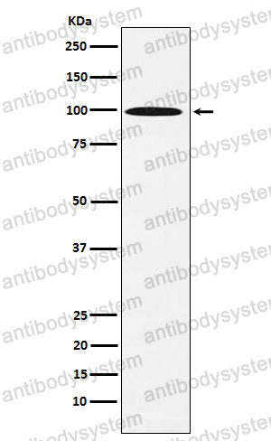 Anti-AP1G1 Antibody (R1E32)