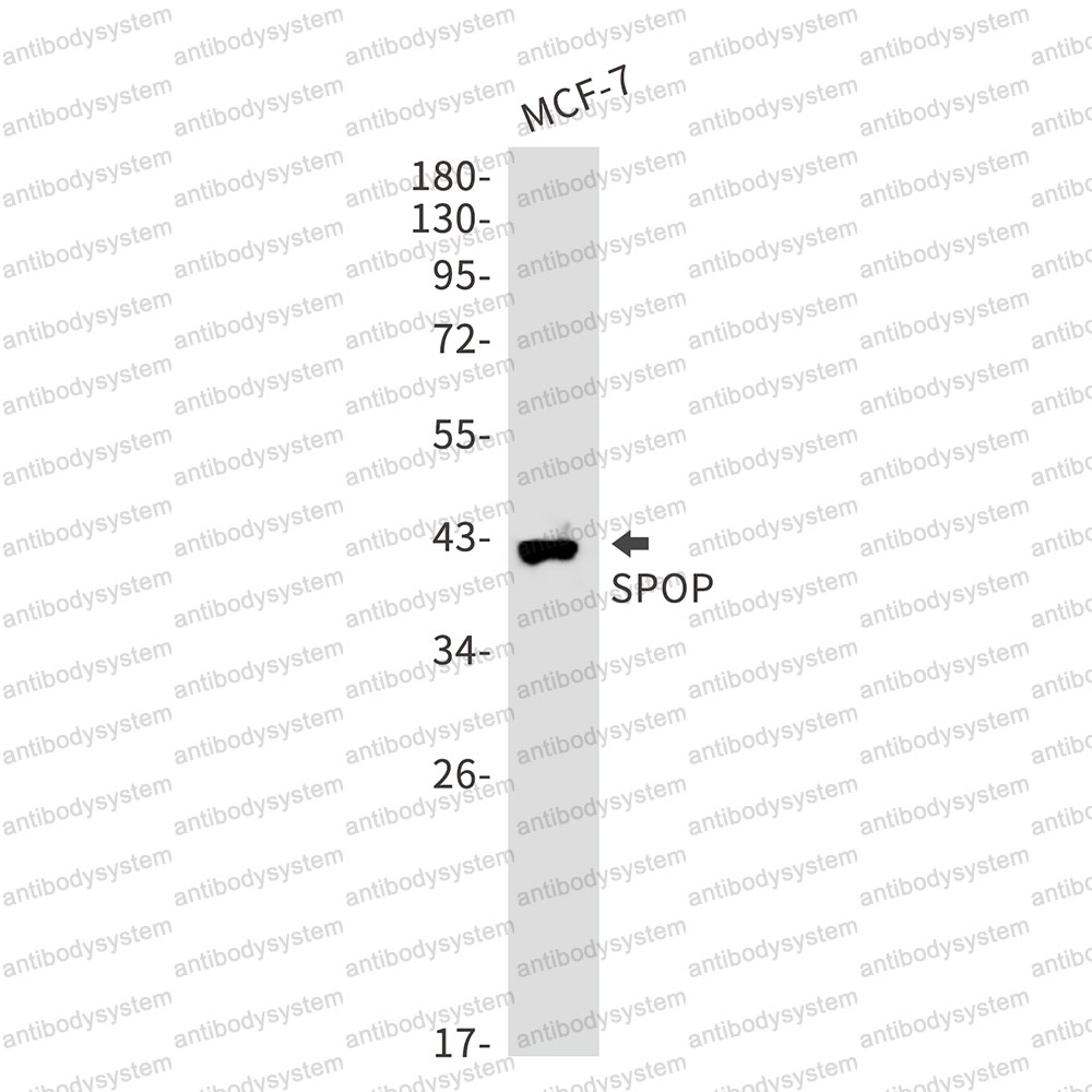 Anti-SPOP Antibody (R1E35)