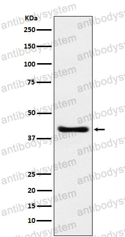 Anti-SPOP Antibody (R1E34)