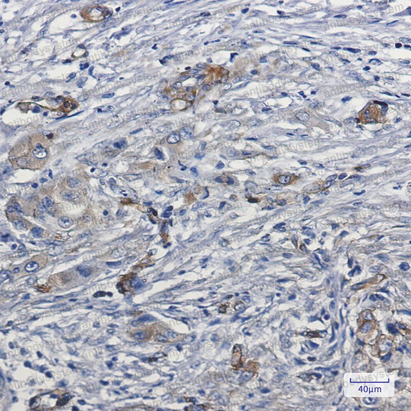 Anti-MYO1B Antibody (R1E37)