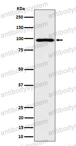 Anti-AKAP8 Antibody (R1E38)