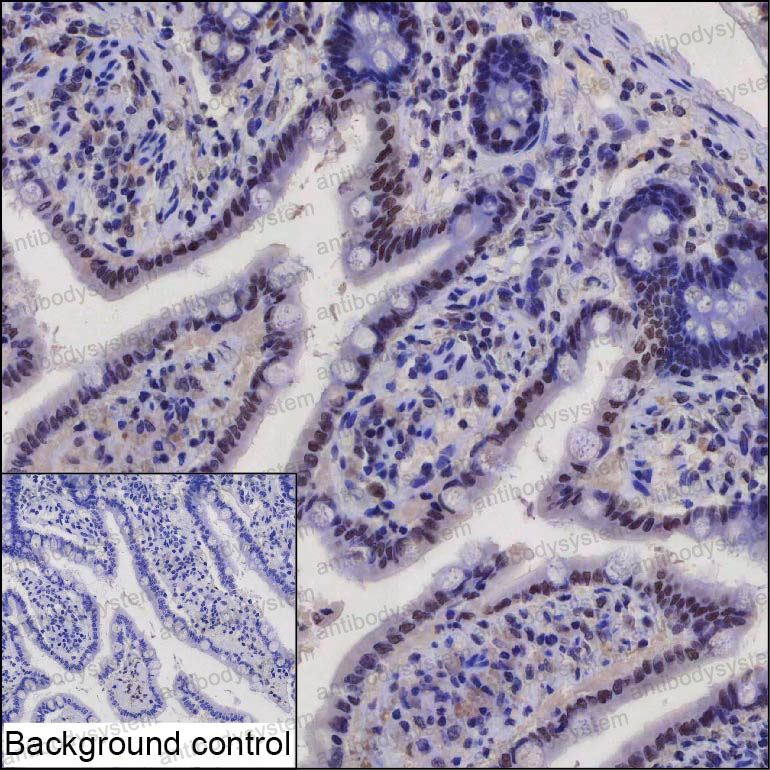 Immunohistochemical for Anti-AKAP8 Antibody (R2V06) ?>
