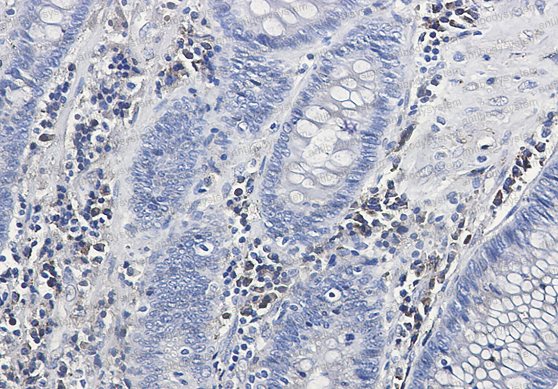 Anti-CALU Antibody (R1E41)