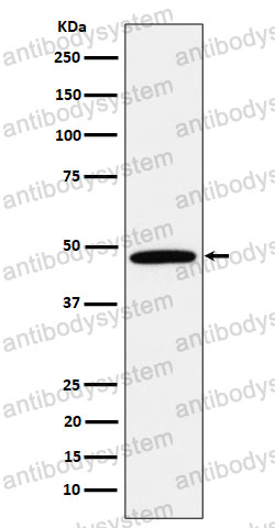 Anti-CALU Antibody (R1E40)