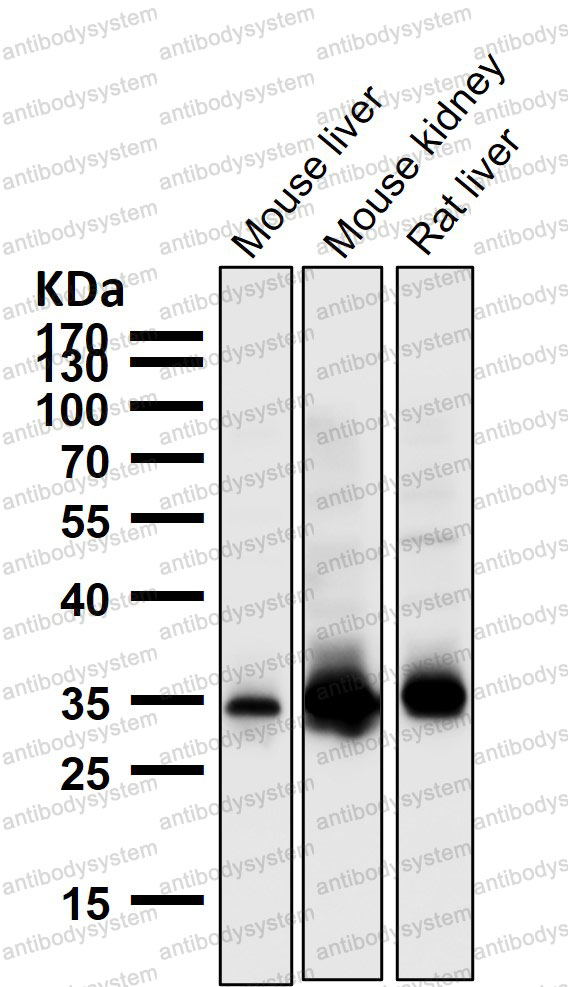 Anti-GAS2 Antibody (R1B61)