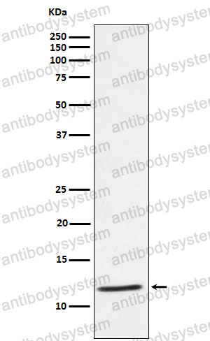 Anti-TYROBP Antibody (R1E42)