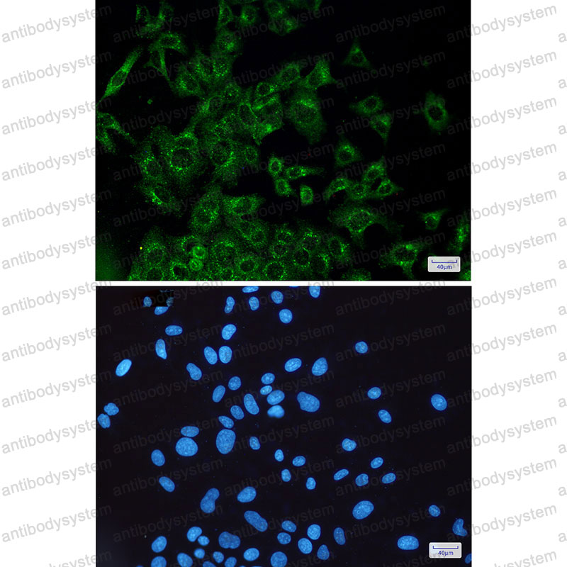 Anti-VEGFD Antibody (R1E44)