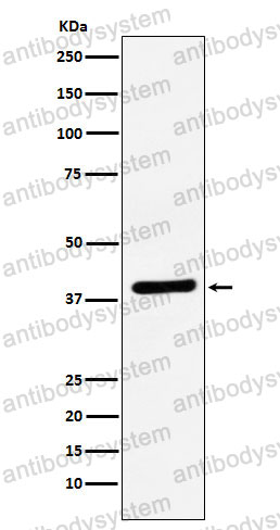 Anti-VEGFD Antibody (R1E43)