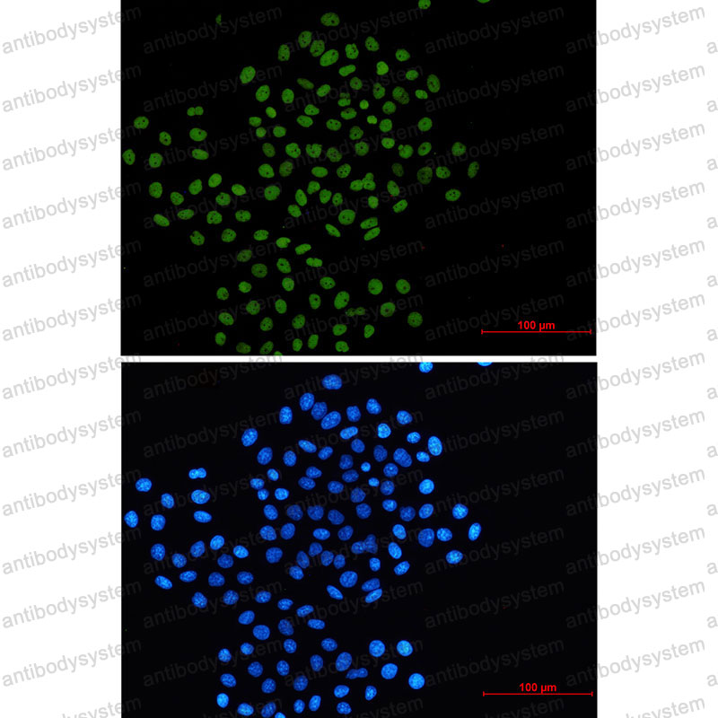 Anti-RAD21 Antibody (R1E45)